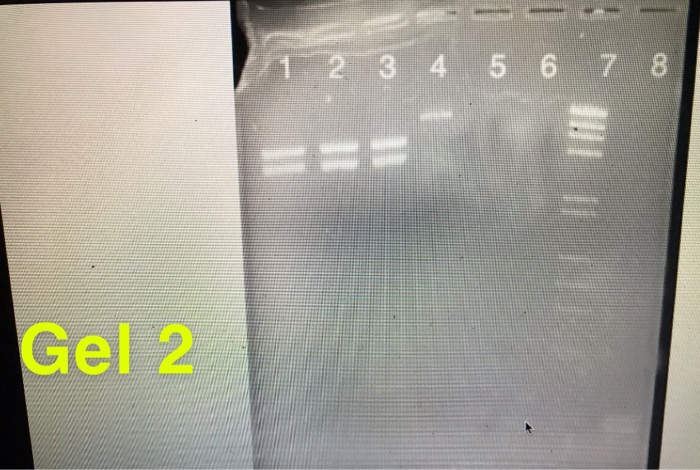 Solved 1. Examine The Picture Of Your Stained Agarose Gel. | Chegg.com