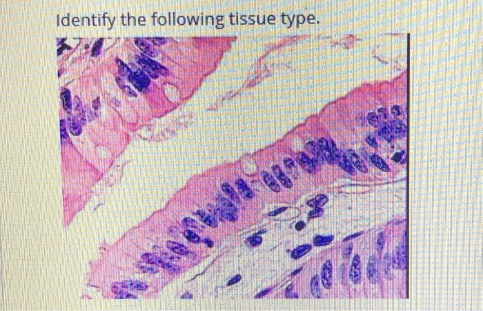 Solved Identify The Following Tissue Type. | Chegg.com