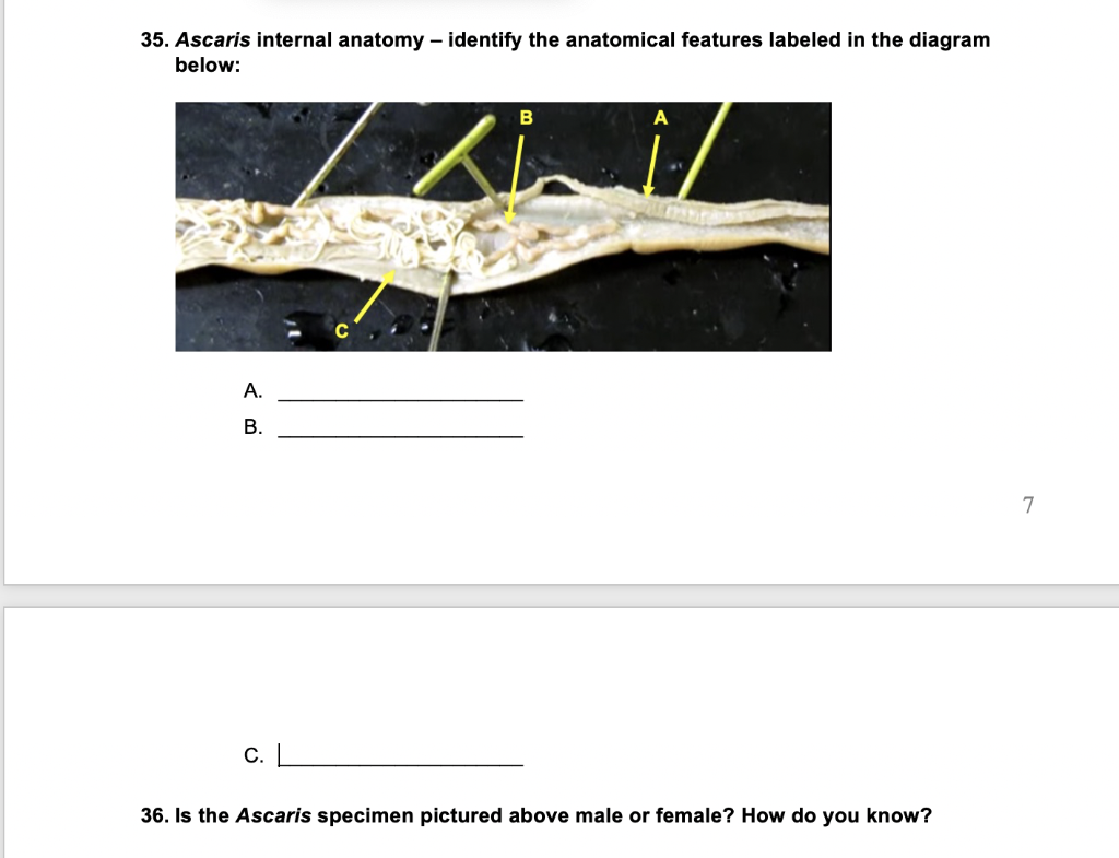 ascaris anatomy diagram