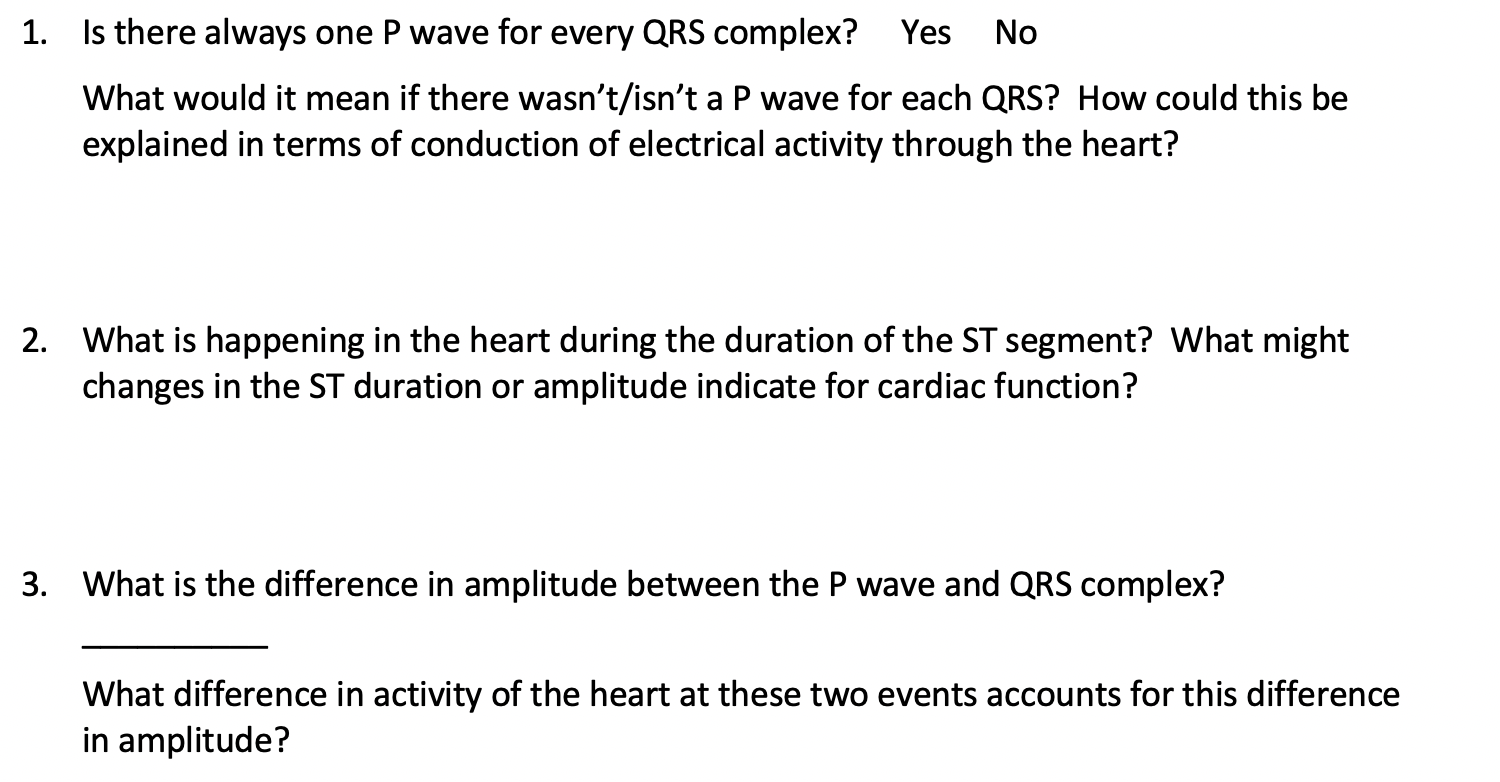 Solved 1 Is There Always One P Wave For Every Qrs Comple Chegg Com