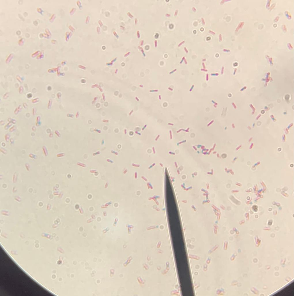 Solved what is the mechanism of endospore stain and | Chegg.com