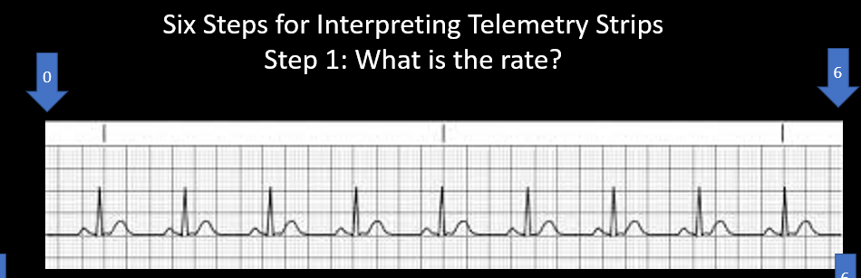 Solved Six Steps For Interpreting Telemetry Strips Step 1: 