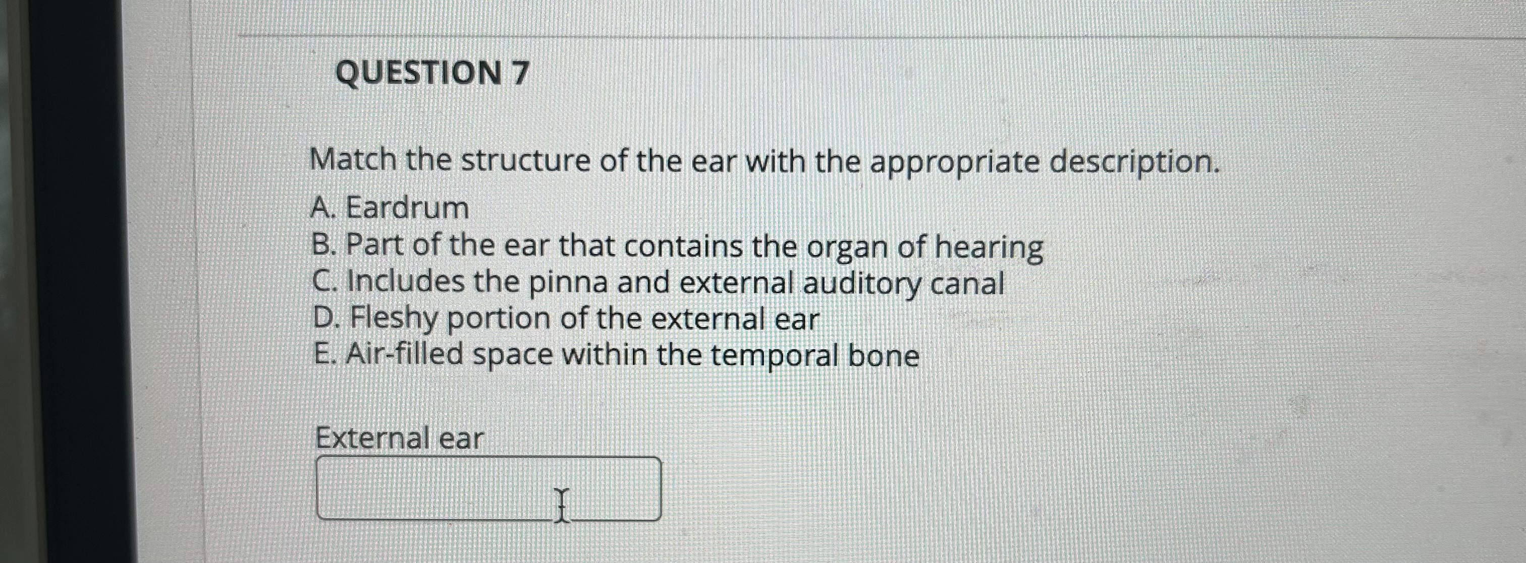 Solved QUESTION 7Match the structure of the ear with the | Chegg.com