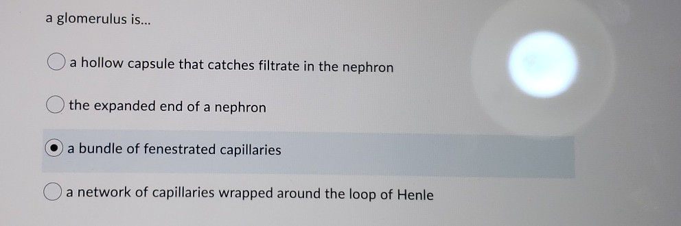 Solved the renal pelvis is where the urine accumulates in | Chegg.com