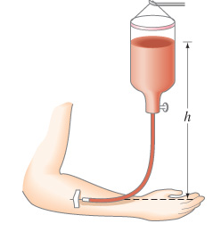 Solved A patient is to be given a blood transfusion. The | Chegg.com