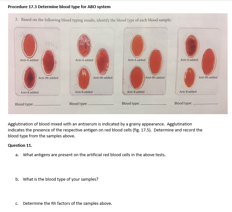 What Factors Determine Blood Type