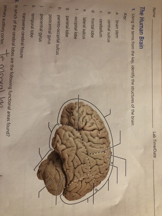 Transverse Sulcus Of Occipital
