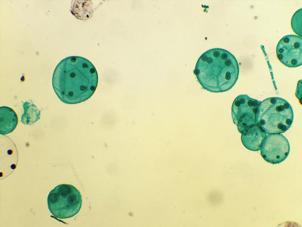Foraminiferal Ultrastructure: A perspective From Fluorescent and  Fluorogenic Probes - Frontalini - 2019 - Journal of Geophysical Research:  Biogeosciences - Wiley Online Library, image size:1024x768