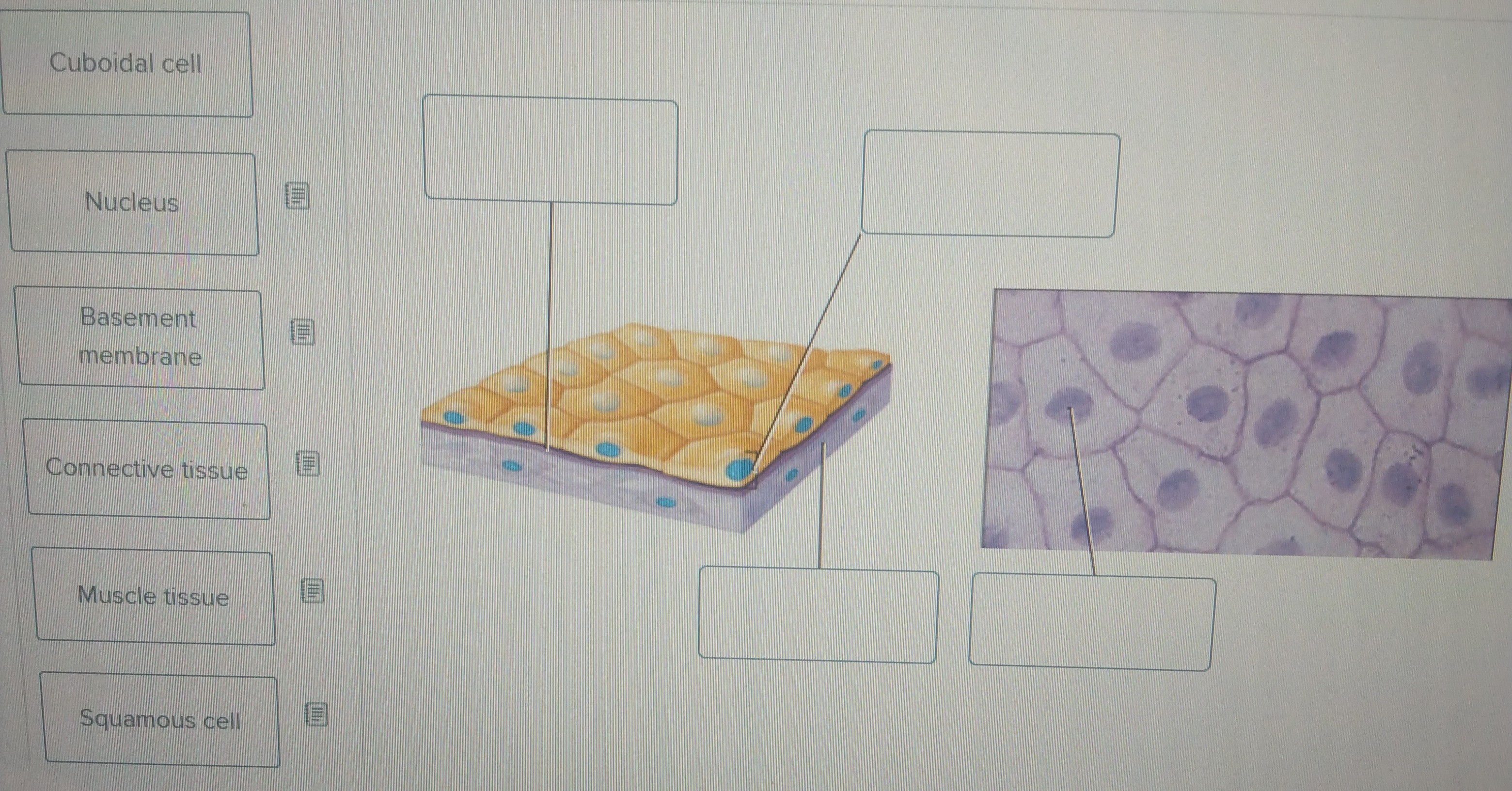 Solved Cuboidal cell Nucleus Basement membrane Connective | Chegg.com