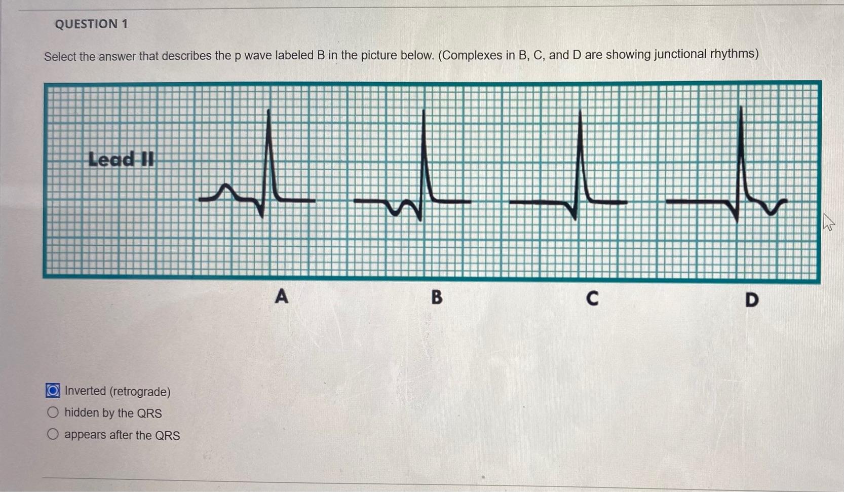 Solved QUESTION 1 Select the answer that describes the p | Chegg.com