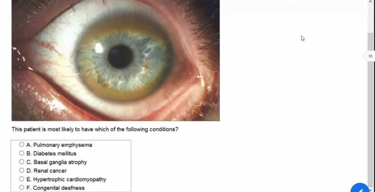 Solved 91 This patient is most likely to have which of the | Chegg.com
