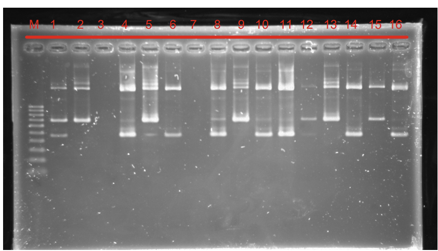 Based on the results of agarose gel electrophoresis | Chegg.com