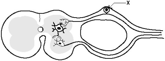 Solved cell body of the motor neuron.cell body of the motor | Chegg.com