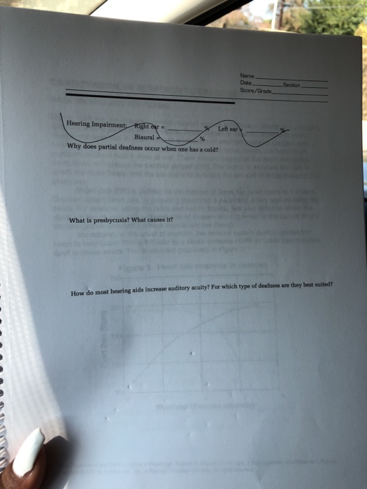 Solved Sensory Physiology Vision 4 Blind Spot What Causes Chegg