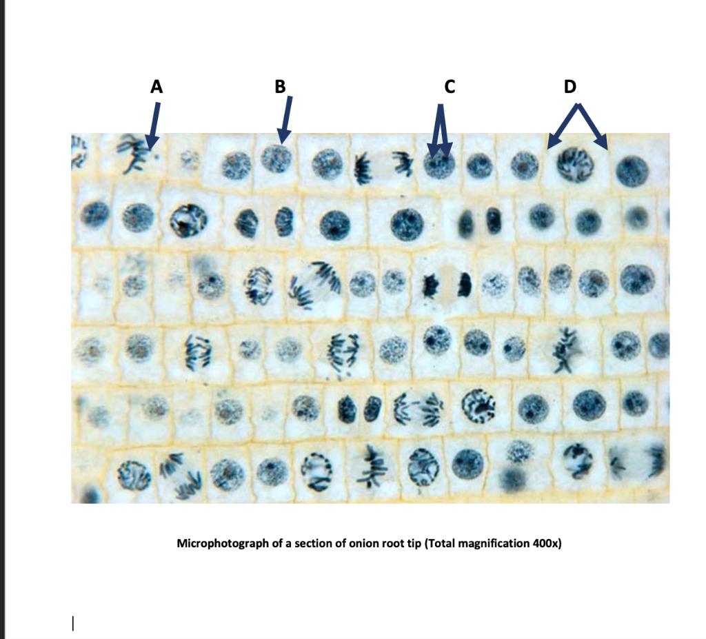 Solved A B D MU Microphotograph of a section of onion root