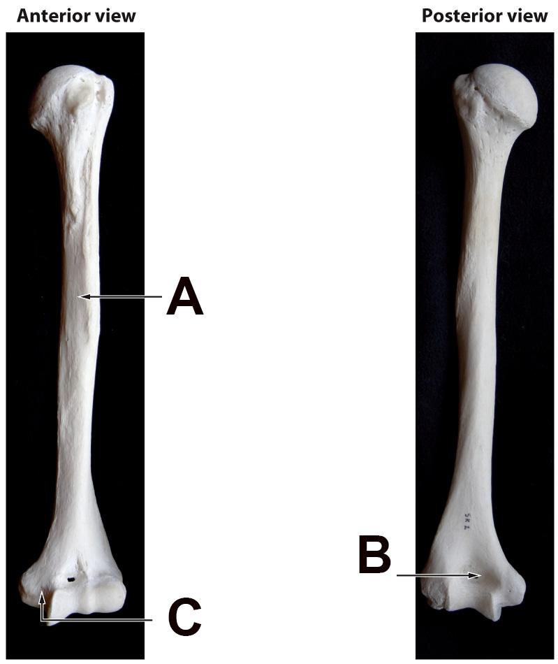 Solved Examine The Humerus (upper Arm Bone) Depicted 