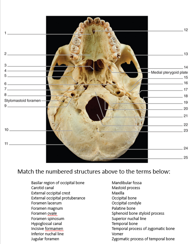 Match the numbered structures above to the terms | Chegg.com