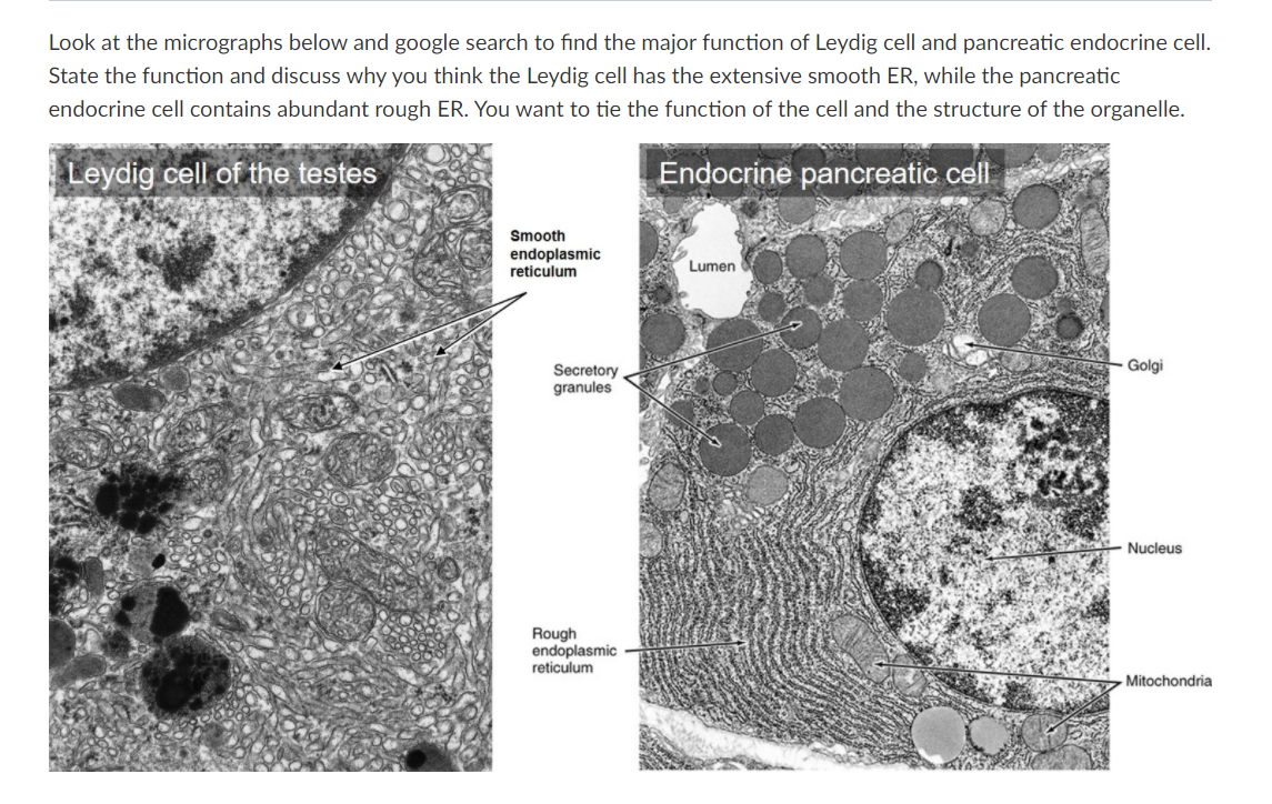 Solved Look at the micrographs below and google search to | Chegg.com