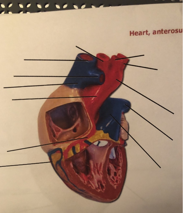 Solved Heart, anterosu | Chegg.com