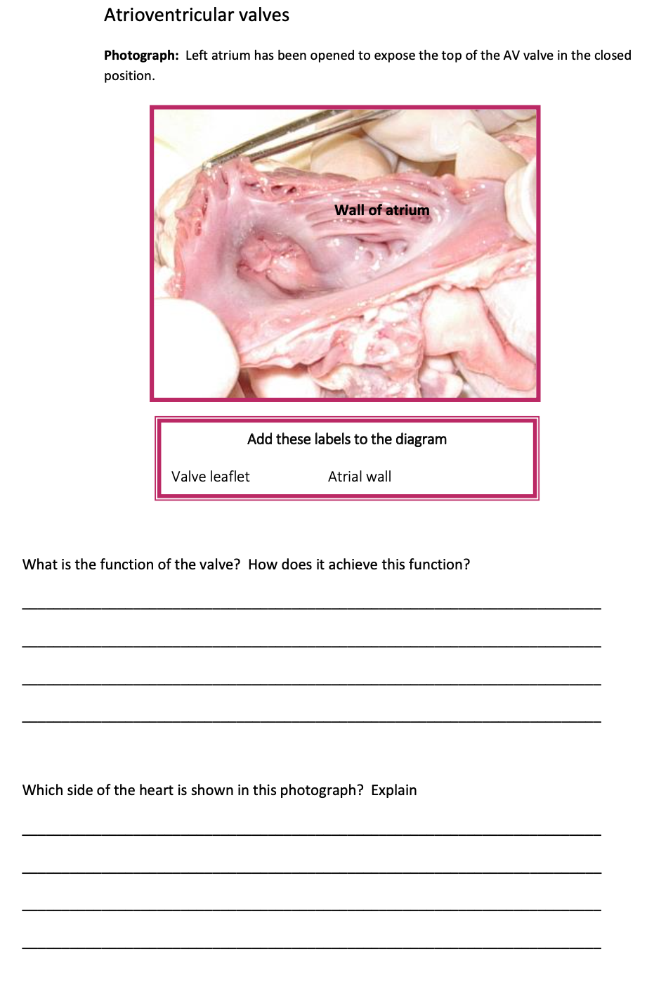 Atrioventricular Valve Function