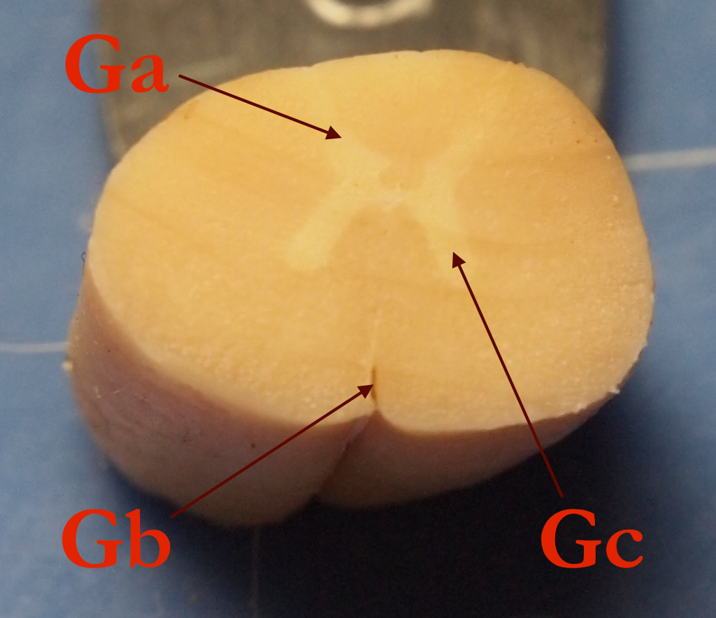 Solved label all parts ventral horn, gray