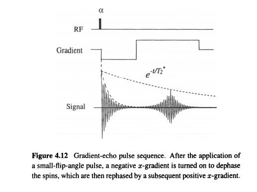 a RF Gradient eM Signal Figure 4.12 Gradient-echo | Chegg.com