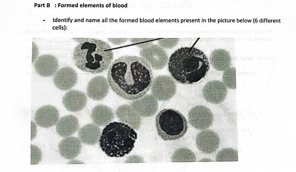 Solved Part B : Formed elements of blood - Identify and name | Chegg.com