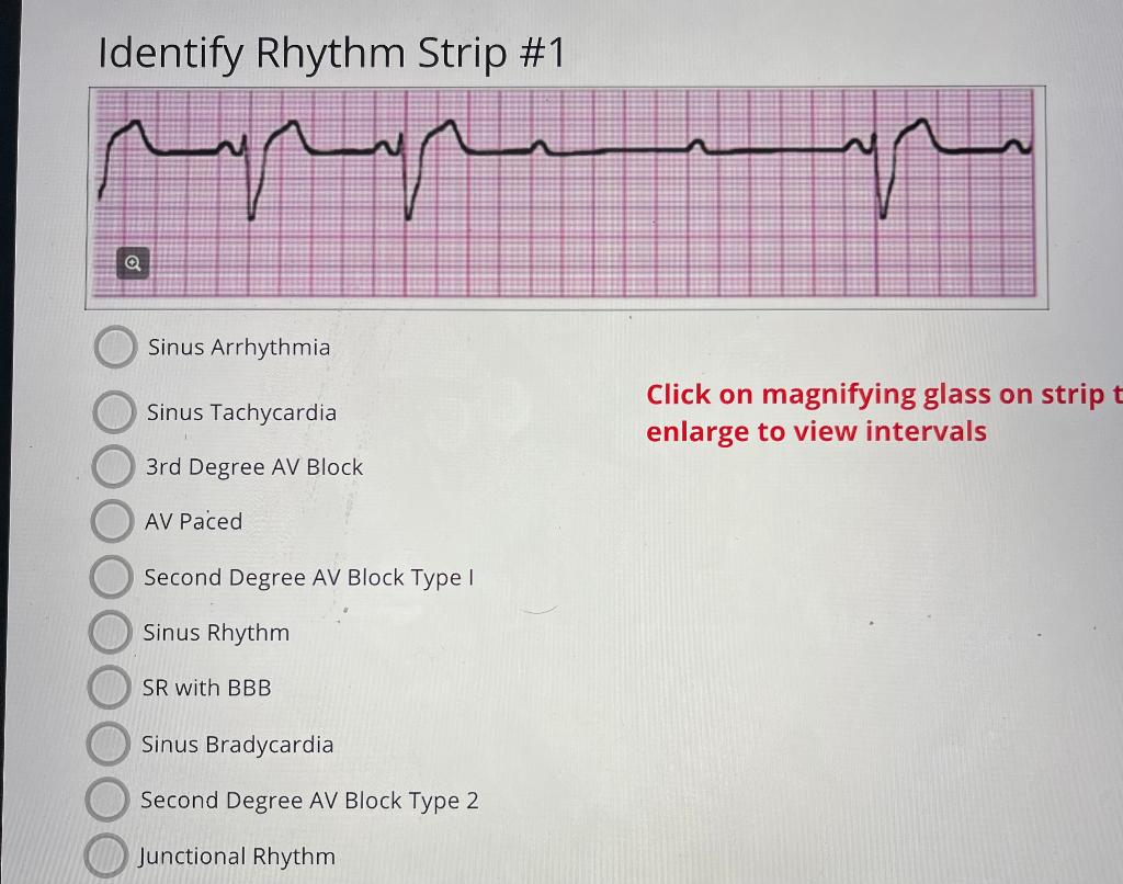 sinus arrhythmia rhythm strip