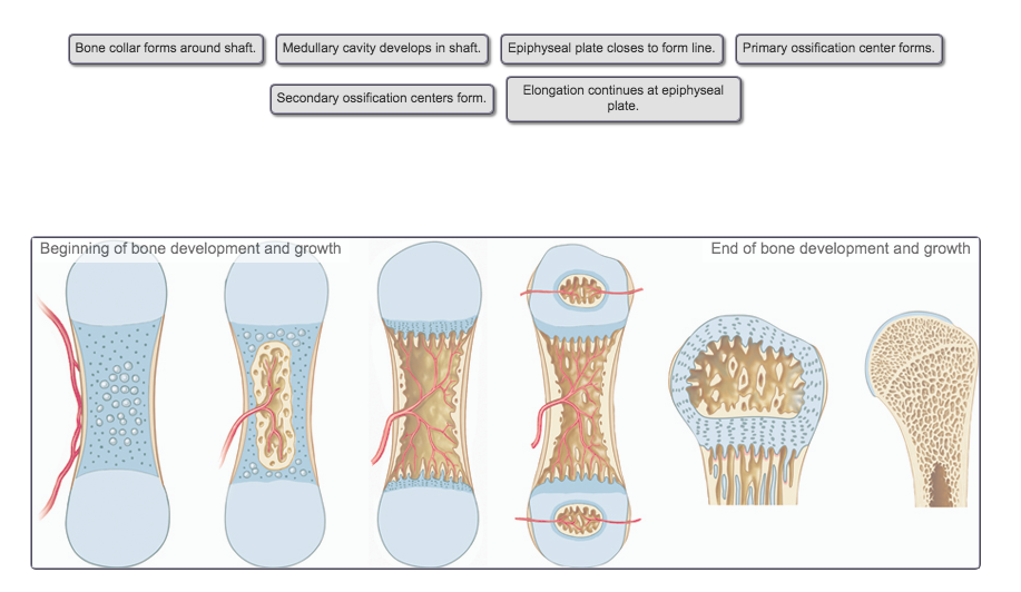 Solved Bone collar forms around shaft. Medullary cavity | Chegg.com