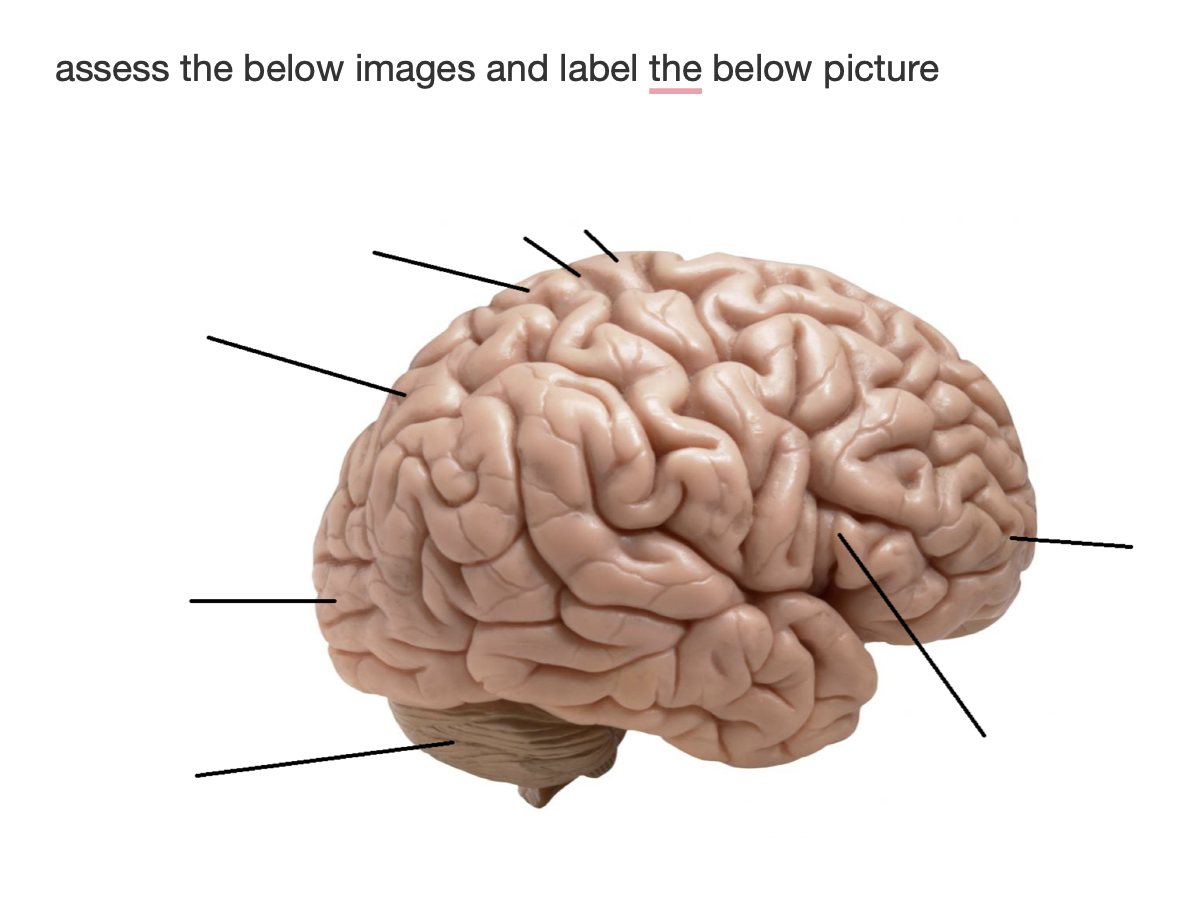 Solved Assess The Below Images And Label The Below Picture | Chegg.com