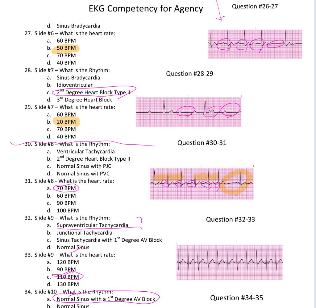 Solved Question #26-27 EKG Competency for Agency سرمره | Chegg.com