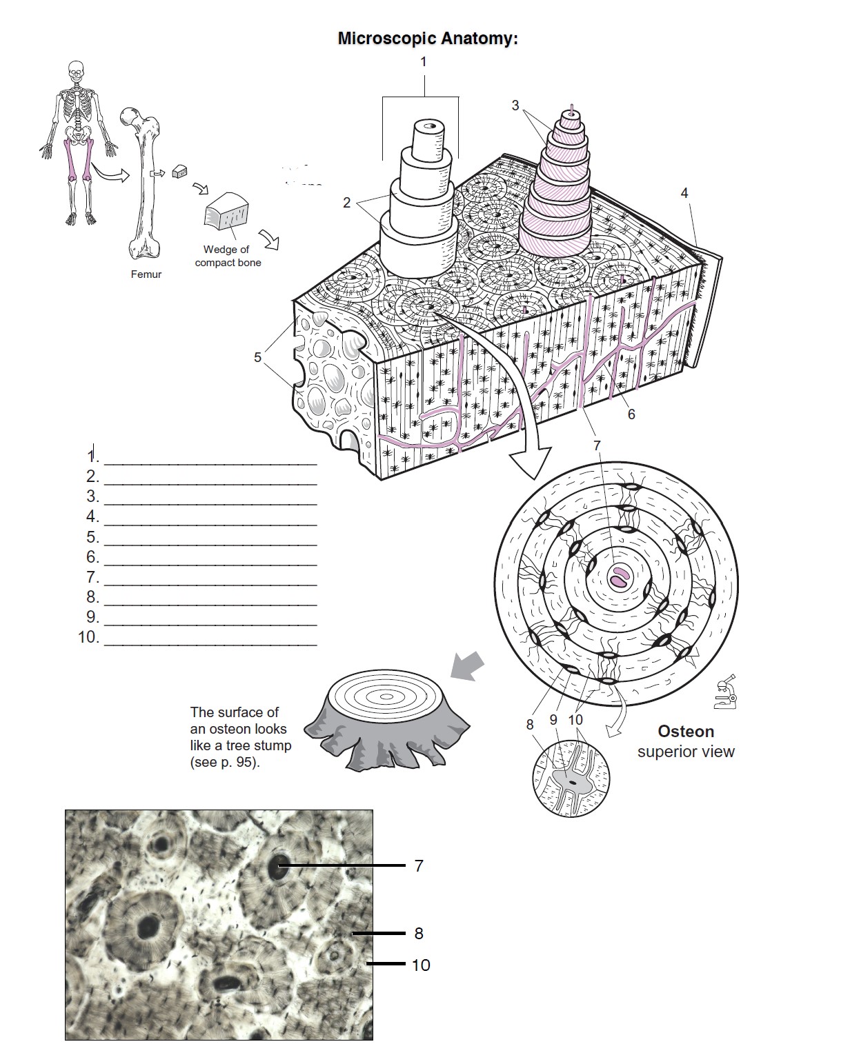 Solved Microscopic Anatomy Periosteum Endosteum Spongy bone | Chegg.com