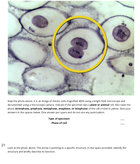 anaphase under microscope