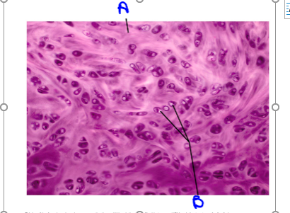 Solved This is______connective tissue. 