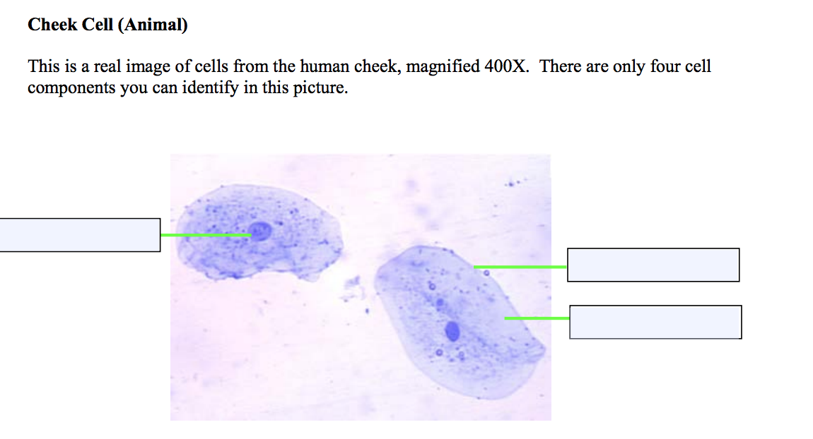 Solved Cheek Cell (Animal) This is a real image of cells 