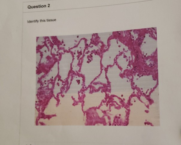 Solved Question 2 Identify This Tissue | Chegg.com