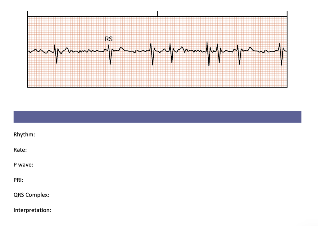 Solved (c) Rhythm: Rate: P wave: PRI: QRS Complex: | Chegg.com