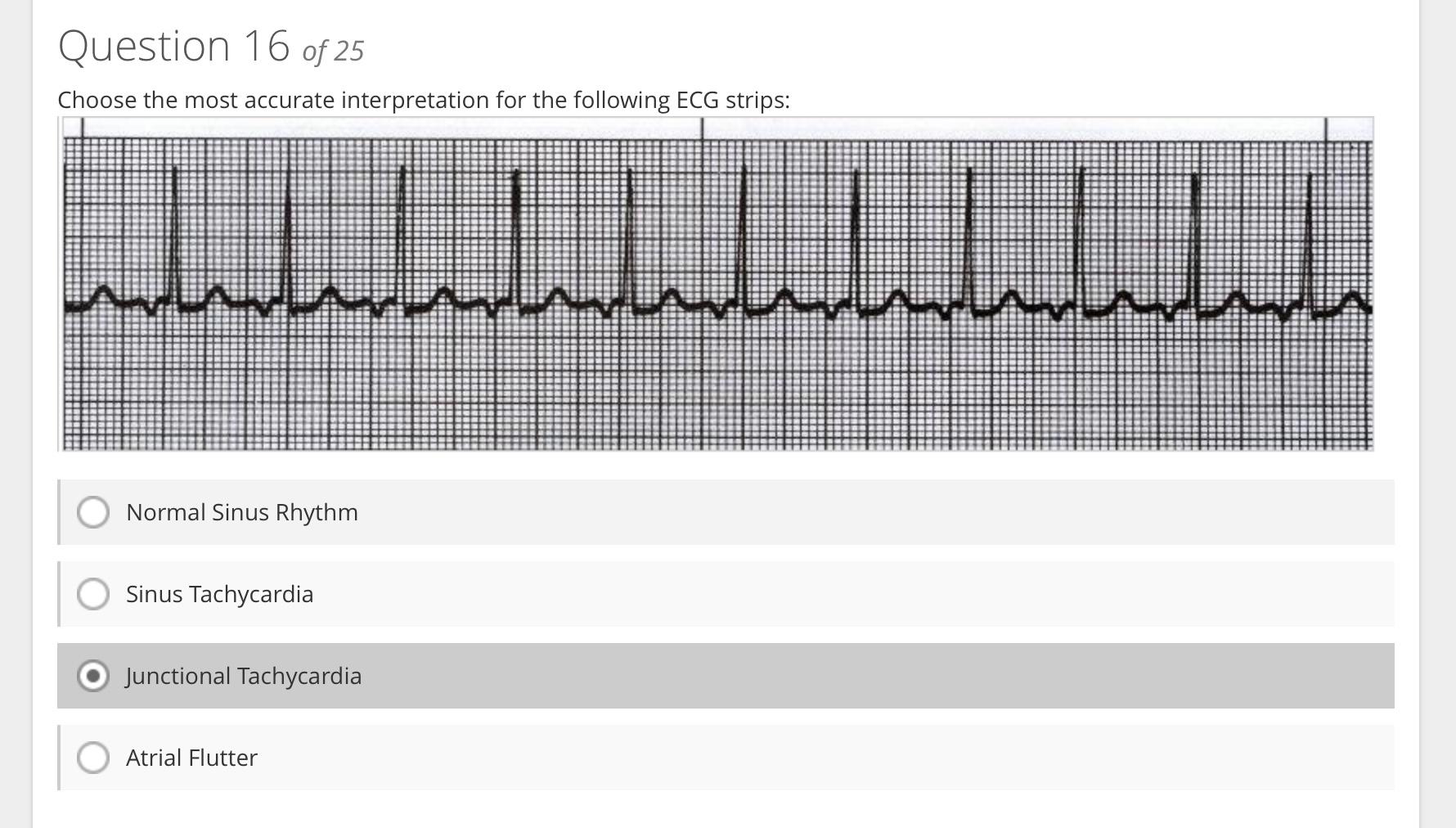 Choose the most accurate interpretation for the following ECG strips:
Normal Sinus Rhythm
Sinus Tachycardia
Junctional Tachyc