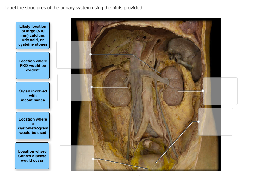 Solved Label the structures of the urinary system using the | Chegg.com
