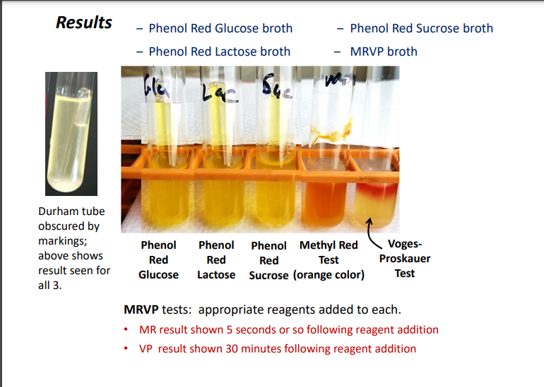 Solved Results - Phenol Red Glucose broth - Phenol Red | Chegg.com