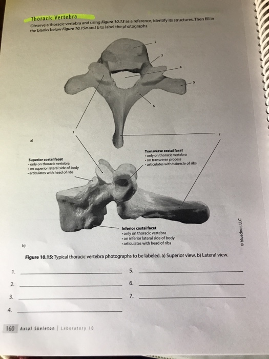 Thoracic Vertebra Lateral View Labeled