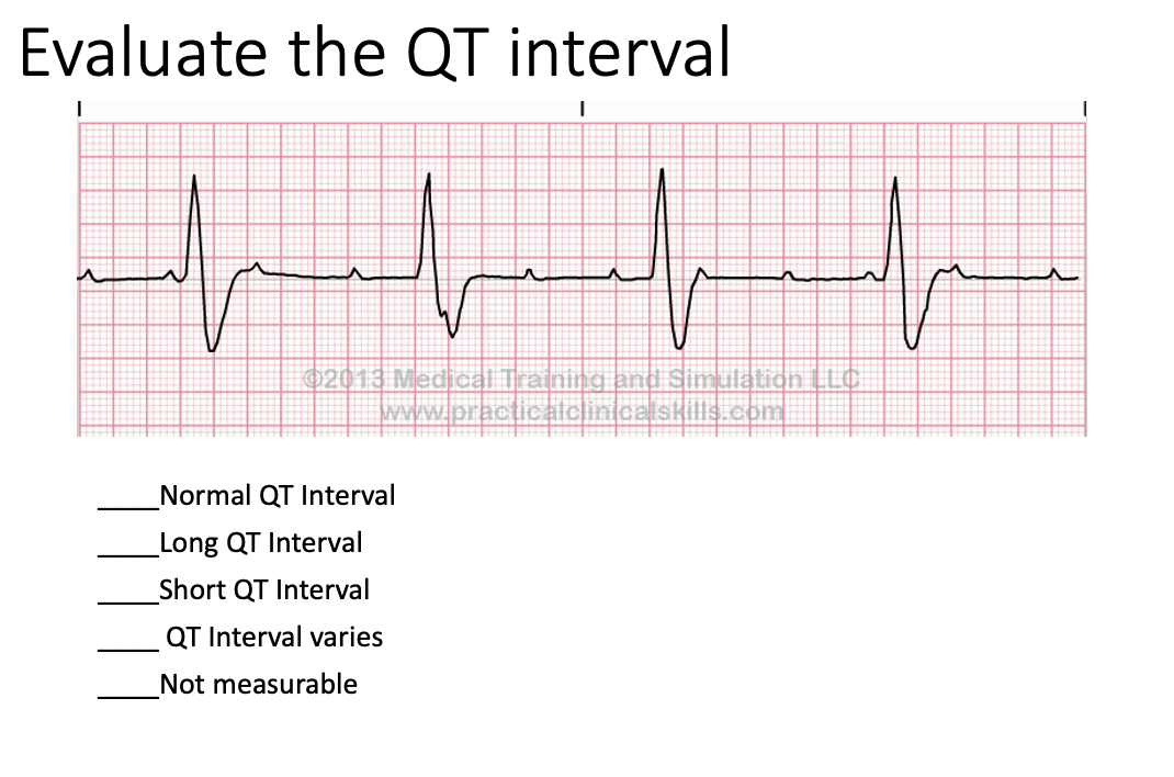 Solved Evaluate the QT intervalNormal QT IntervalLong QT | Chegg.com