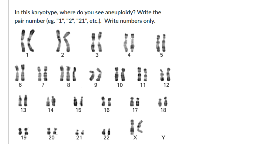 Solved In this karyotype, where do you see aneuploidy? Write | Chegg.com