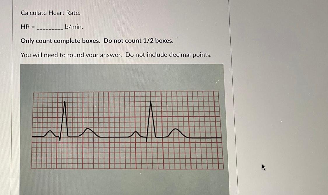 Solved Calculate Heart Rate. HR = B/min. Only Count Complete | Chegg.com