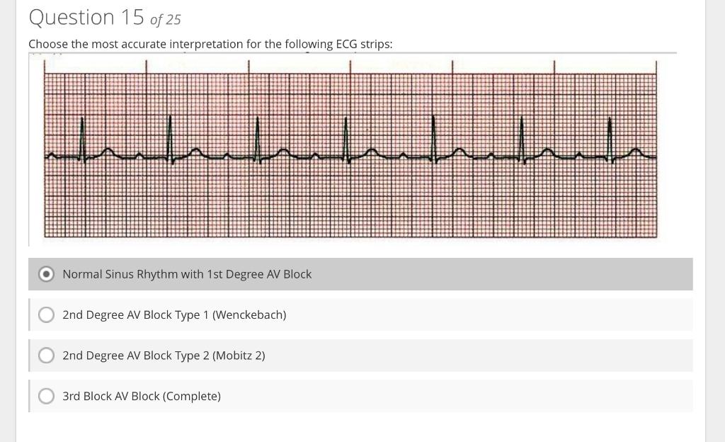 Choose the most accurate interpretation for the following ECG strips:
Normal Sinus Rhythm with 1st Degree AV Block
2nd Degree