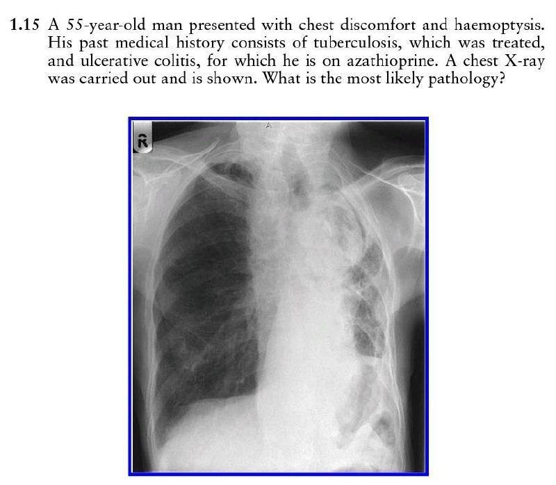 Solved 1.15 A 55-year-old man presented with chest | Chegg.com