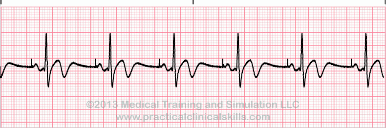 Solved The medical assistant is preparing to perform an EKG | Chegg.com