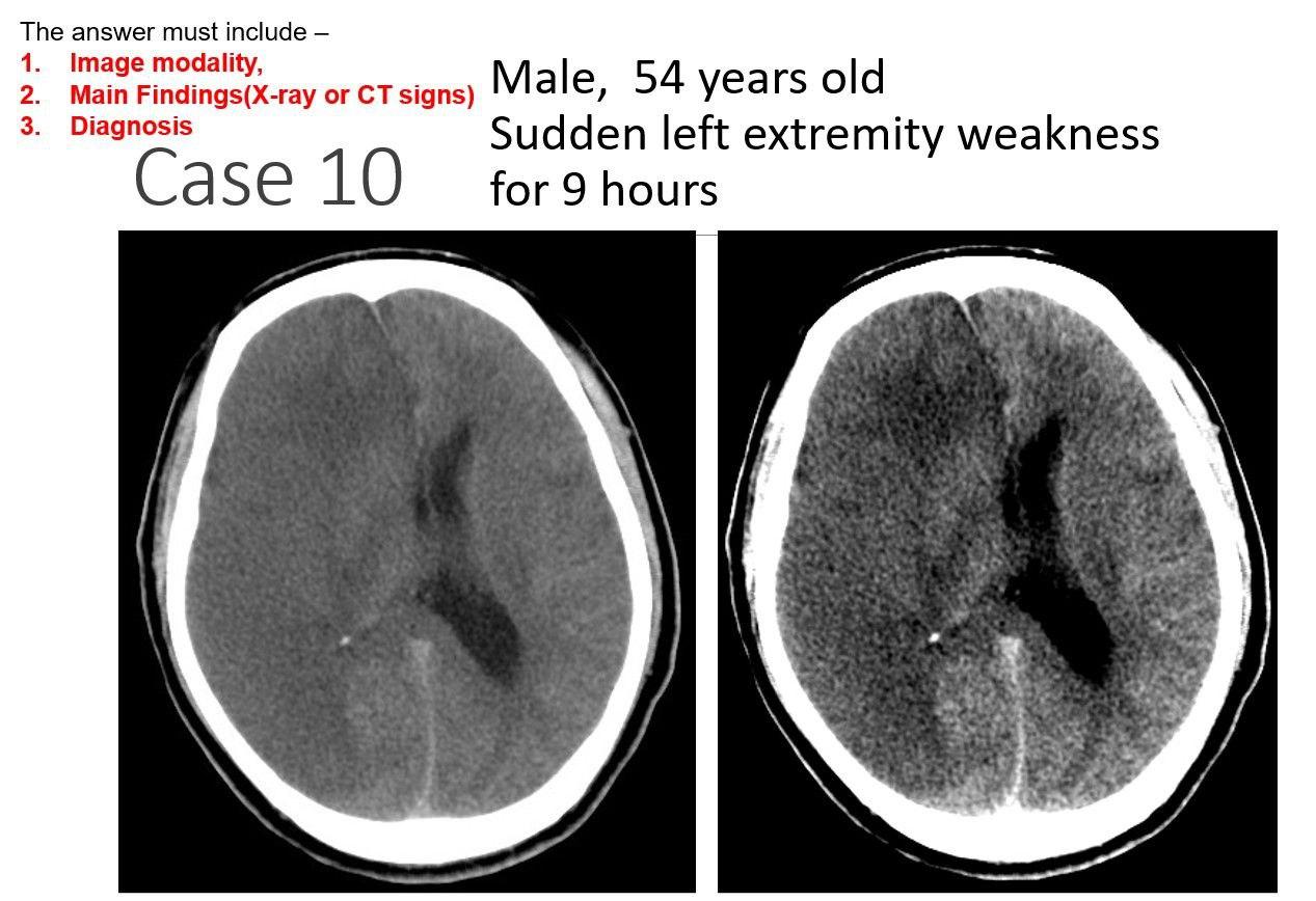 Solved This Is Medical Imaging Radiology Subject From MBBS, | Chegg.com