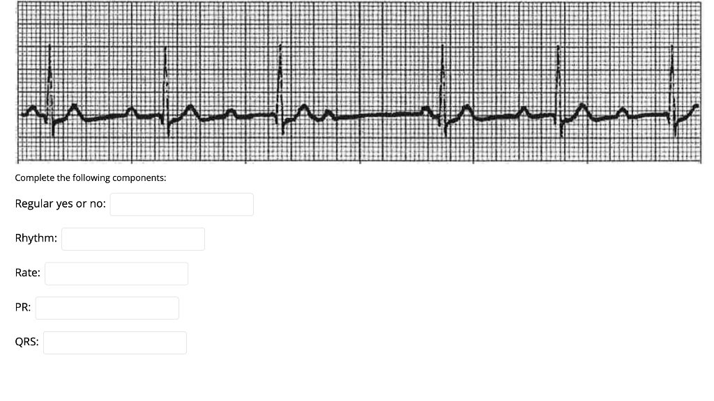 w Complete the following components: Regular yes or no: Rhythm: Rate: PR: QRS: