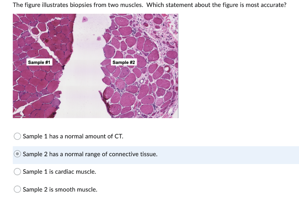 Sample 1 has a normal amount of CT. Sample 2 has a normal range of connective tissue. Sample 1 is cardiac muscle. Sample 2 is